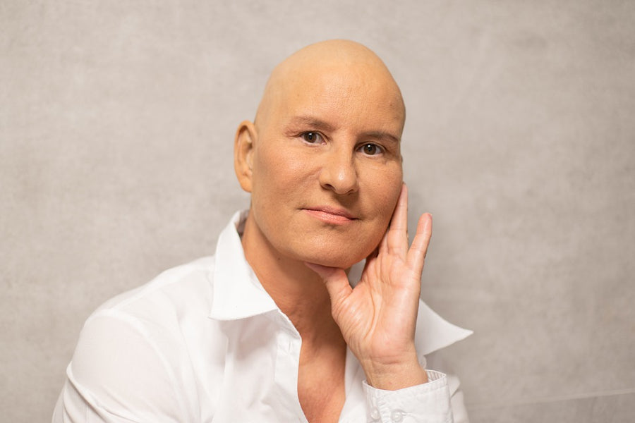 Chemotherapy induced hair loss