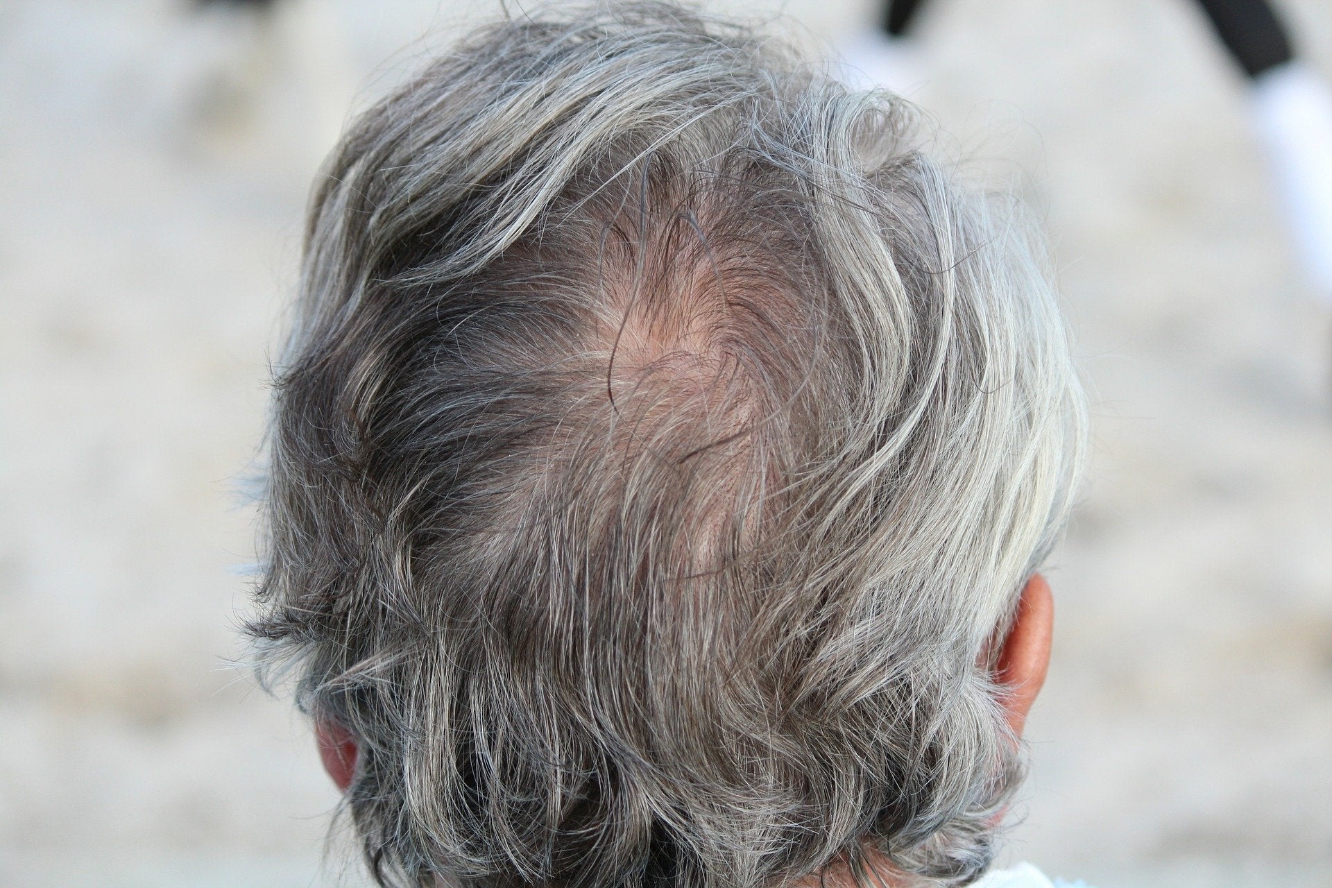 Don’t worry, but can stress really turn your hair grey?