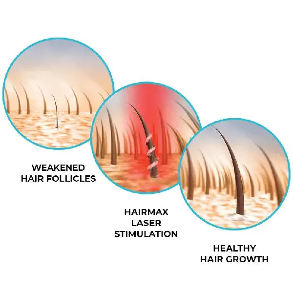 REGROW MD LASER 272 hairmax.co.uk