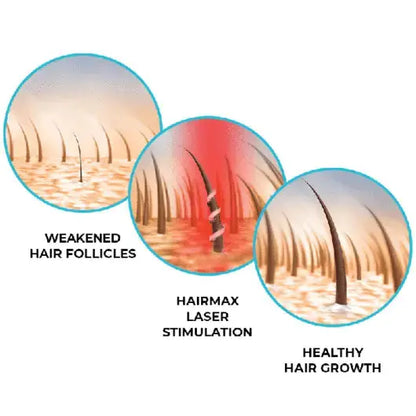 LASER 272 POWERFLEX CAP hairmax.co.uk